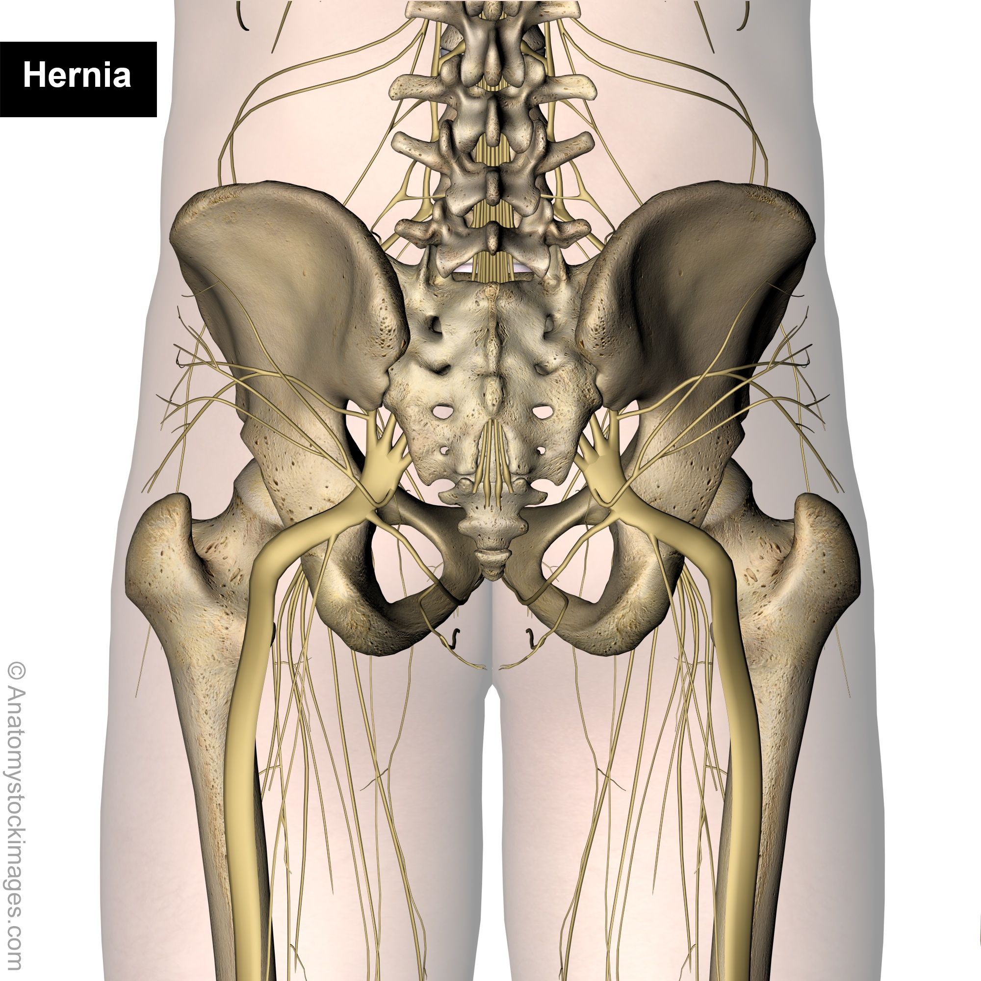 Lubar_radicular_syndrome_back