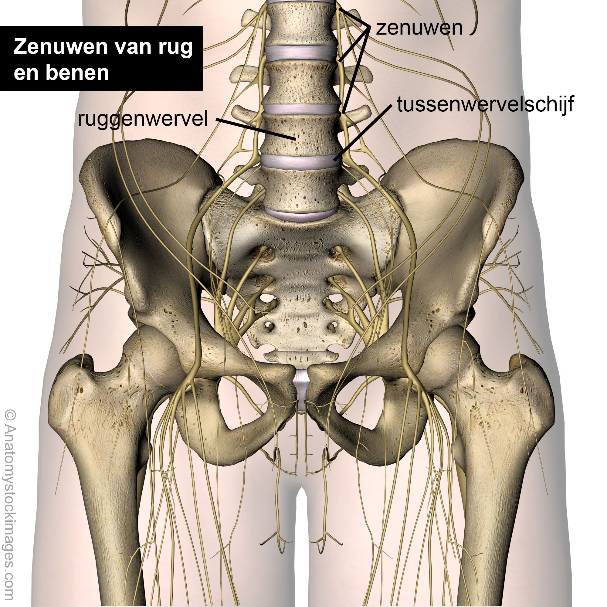 Lumbar_radicular_syndrome