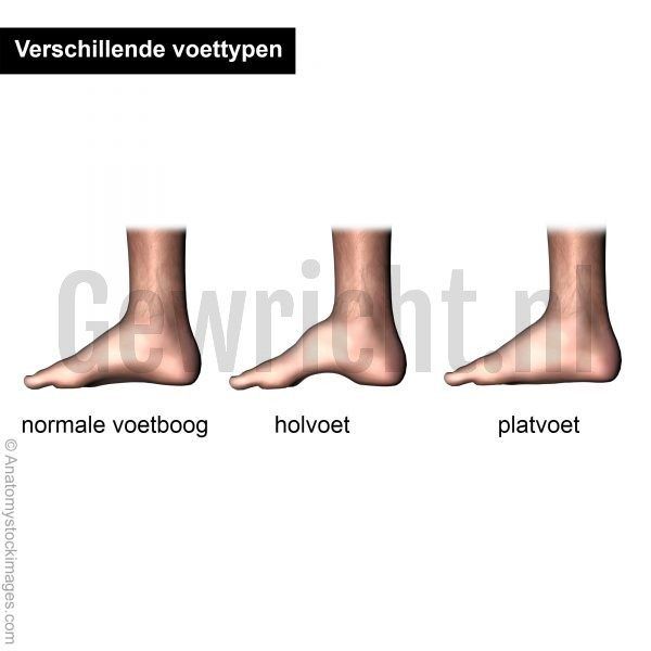 foot-arches