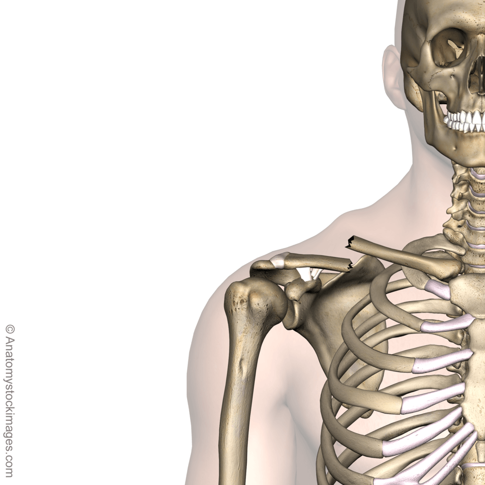 shoulder-clavicula-fracture-clavicle-broken-collarbone-front-skin